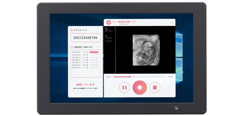 4 3D・4Dエコー(超音波検査)